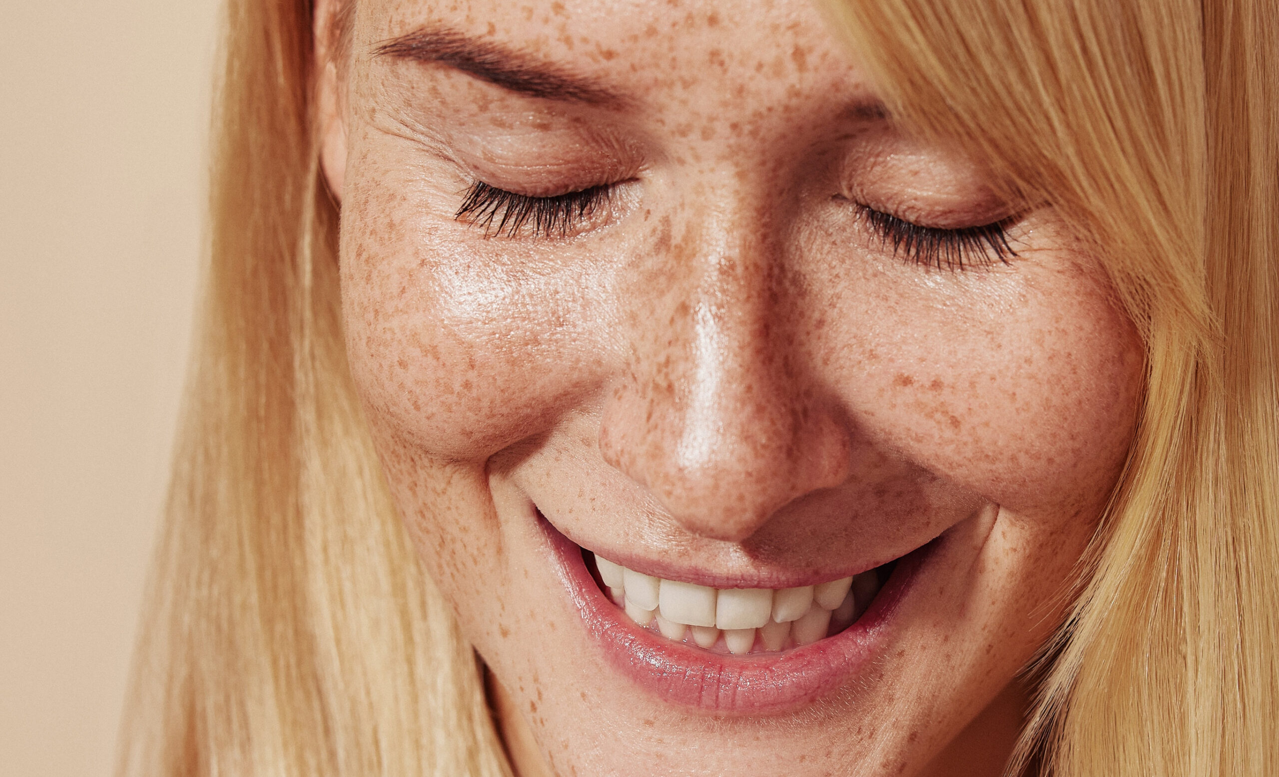Dermatologia – Manejo de Complicações em Estética